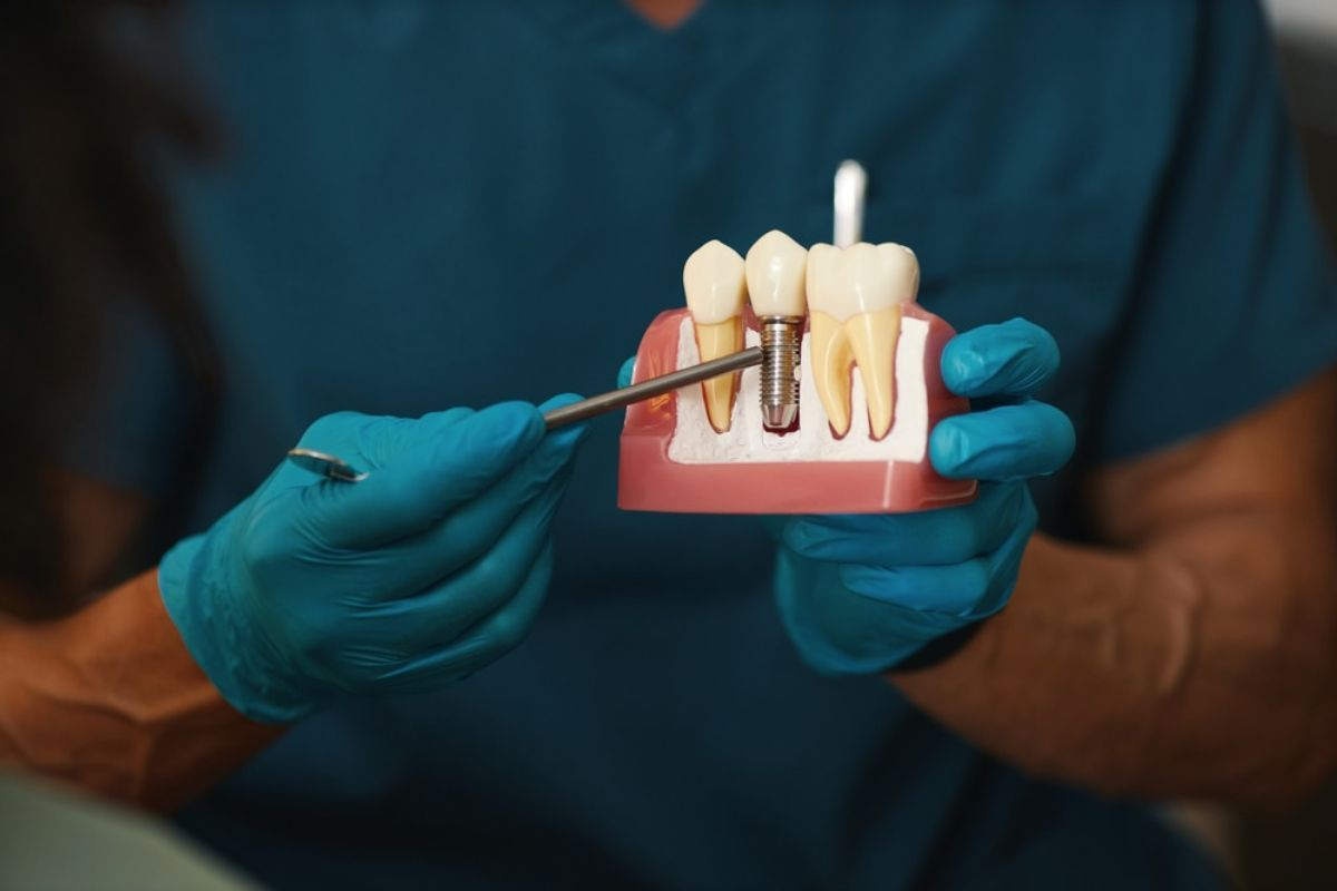 Dentist pointing to a dental implant on an anatomical model